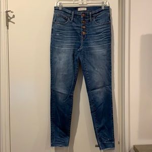 Madewell Button Fly Skinny Jeans